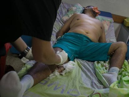 A doctor treats a patient without pain killers at Periferico de Coche, near Caracas.