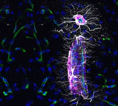 Microscopic image of brain cells from mice that received cerebrospinal fluid from young people.