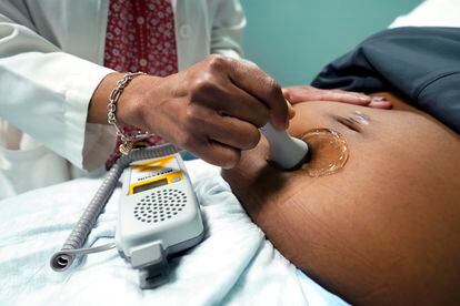 Doctor uses a hand-held Doppler probe on a pregnant woman