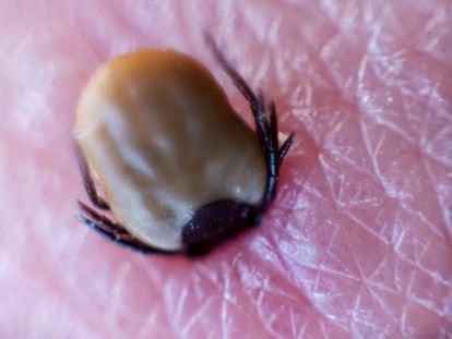 A macro photograph of a tick biting into the skin of a person, in Herrnleis, Lower Austria, Austria, 28 April 2023.