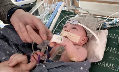 Owen Monroe, just a few weeks old, after receiving a partial heart transplant at Duke University Hospital (North Carolina, USA).
