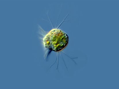 Protists of the Halteria genus, like the one pictured above, are water-based microorganisms found in freshwater reservoirs across the planet.