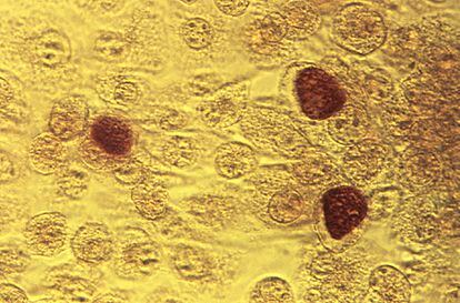 This 1975 microscope image made available by the the Centers for Disease Control and Prevention shows Chlamydia trachomatis bacteria