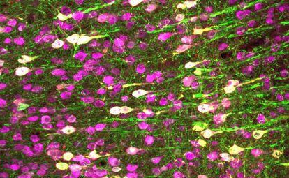The neurons of a mouse in magenta. The white ones are those that have expressed the TRPA1 protein and are thus sensitive to ultrasound.