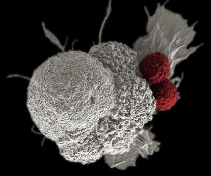 Two T lymphocytes (in red) attack a cancer cell (in white).