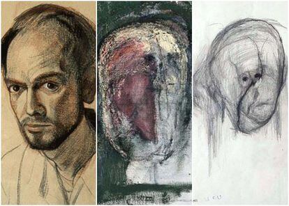Three self-portraits by William Utermohlen in 1967, 1999 and 2000. Utermohlen died anonymously in 2007 at the age of 73, but his works are important for understanding neurodegenerative disorders.