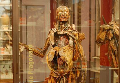 One of the flayed corpses from the 18th century exhibited in the Fragonard Museum near Paris.