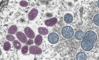 A microscopic image of the monkeypox virus.