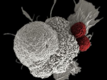 Cytotoxic T lymphocytes, in red, attack cancer cells, in white.
