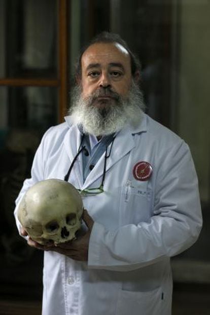 Fermín Viejo holds one of the museum's 2,000 skulls.