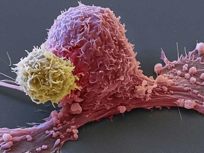 Image of a tumor cell (pink) attacked by a T lymphocyte (yellow).
