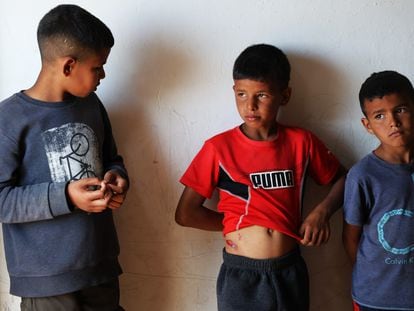 Naser (center), Amina's brother, shows the injury caused while he was running to flee the Iranian attack when a piece of projectile fell into the room where the family was sleeping.