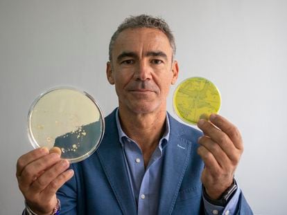 The microbiologist Bruno González Zorn showing bacteria cultures at Madrid's Complutense University.