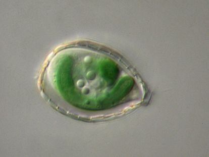 Seen through a microscope, an amoeba of the genus Paulinella exhibits two green, photosynthetic organelles