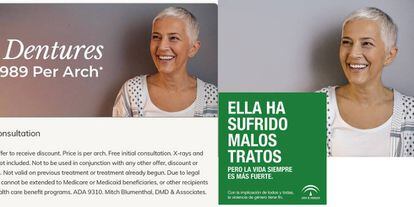 Photo of woman in dental clinic ad (l) also used to represent a victim of abuse (r).