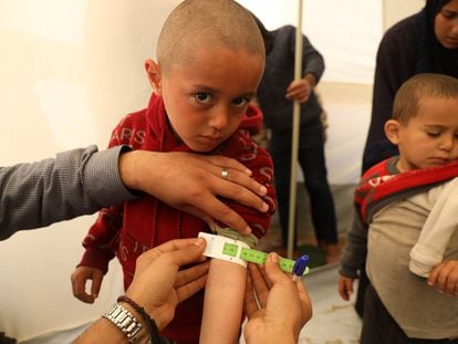 A health worker measures 3-year-old Mohammad's arm to determine if he is malnourished, in Rafah, on March 19, 2024.