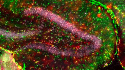 An image of glutamatergic astrocytes in a hippocampus, taken by the research team from the University of Lausanne, Switzerland.