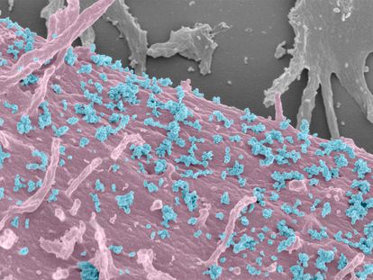 A human cell (pink) secreting exosomes (blue) in an image taken with a scanning electron microscope.