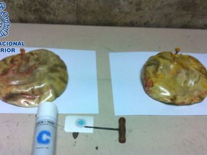 The implants that were taken out of the woman.