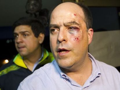 Venezuelan opposition lawmaker Julio Borges was injured in the fight that broke out in the National Assembly Wednesday.