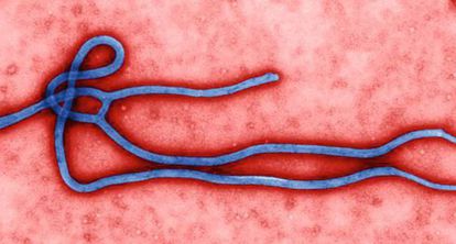 The ebola virus.
