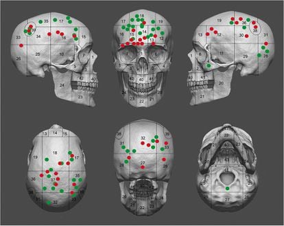 A 3D recreation of the head wounds in the human remains. Green reflects scarred skull traumas, while red represents unhealed injuries, i.e., the ones that killed them. 