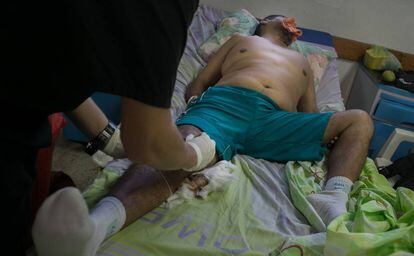 A doctor treats a patient without pain killers at Periferico de Coche, near Caracas.