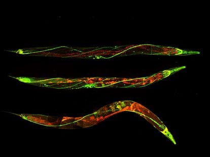 The nervous system of the worm 'C. elegans' is very similar to that of humans.