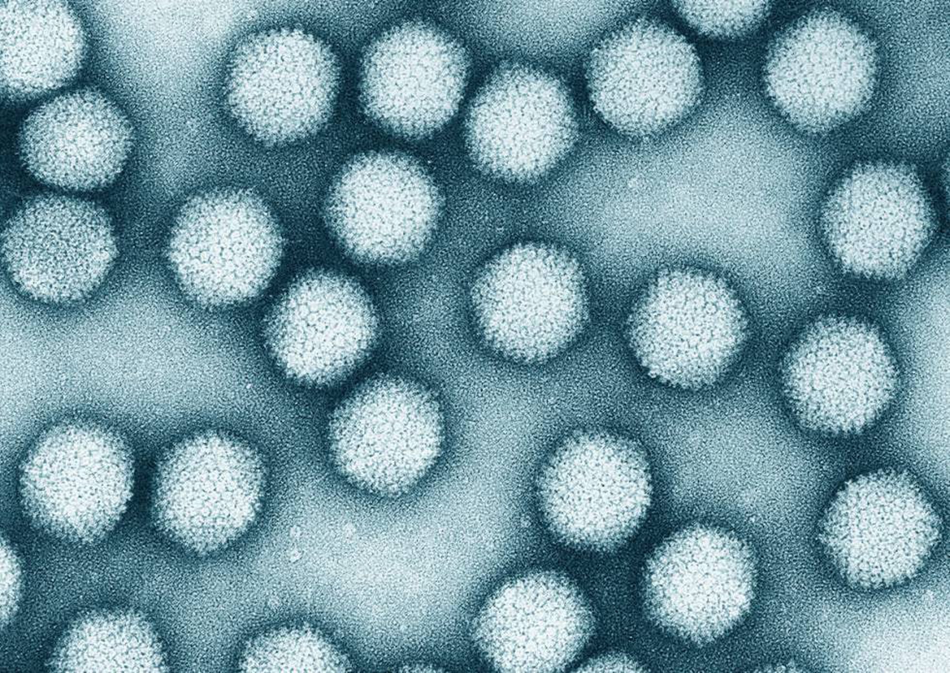Аденовирус гриппа. Аденовирус под микроскопом. Вирус аденовирус. Аденовирусы микробиология. Культивирование аденовируса.
