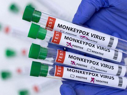 Samples from patients suspected of having monkeypox with test results noted on the label.
