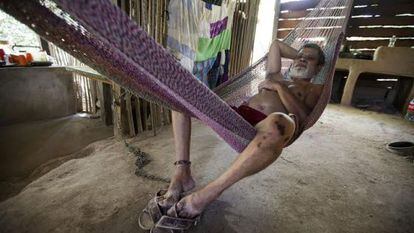 Enrique Chávez, a torture victim of the Mexican army, now lives 24 hours a day chained to a post.