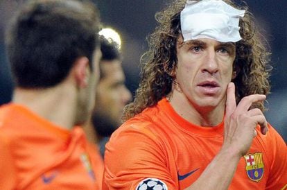 FC Barcelona&#039;s Carles Puyol took a bash to the head in the San Siro.
