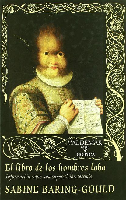Síndrome del hombre lobo