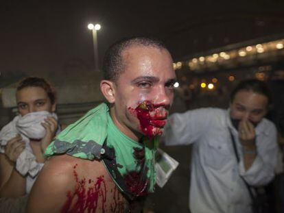A demonstrator is seen with a foreign object in his face during clashes with riot police in a protest against bus fare price hikes June 20, 2013 in Rio de Janeiro, Brazil. 