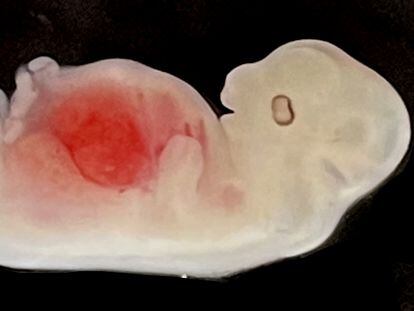 A 28-day-old pig embryo with a blueprint of a human kidney. Photo courtesy of GIBH.