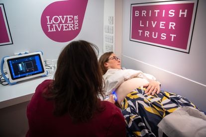 Scanning a patient's liver at the International Liver Congress held in June in London.
