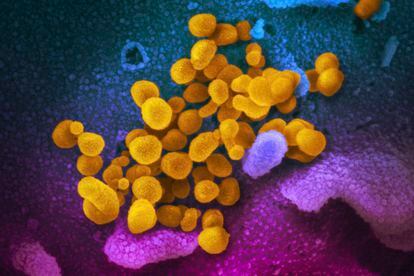 This undated, colorized electron microscope image made available by the U.S. National Institutes of Health in February 2020 shows the Novel Coronavirus SARS-CoV-2, indicated in yellow, emerging from the surface of cells, indicated in blue/pink, cultured in a laboratory.
