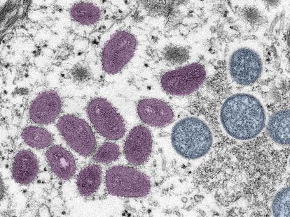 A microscopic image of the monkeypox virus.