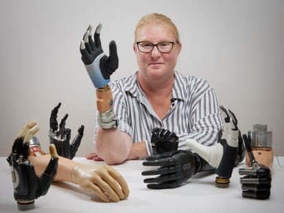 Karin, the Swedish woman who has been living with a bionic hand for the past three years.