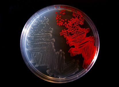 Cultivated bacteria in a laboratory.