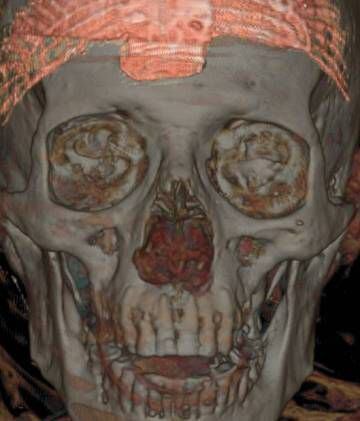 Tomography of Nespamedu’s mummy.