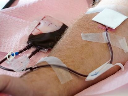 Tubes direct blood from a donor into a bag in Davenport, Iowa, on Friday, Nov. 11, 2022.