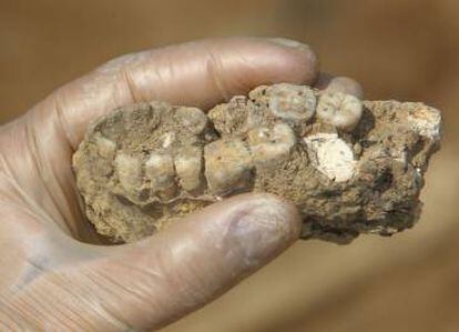 The human teeth found at the Turuñuelo dig.