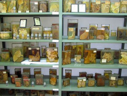 Flasks with diseased organs at the Basque Museum of the History of Medicine in Leioa (Spain).