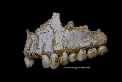 The jaw of the Neanderthal from the El Sidrón cave with poplar bark traces.