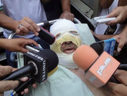 Fernando Vidal talks to reporters after he suffered burns when his radio station was attacked.