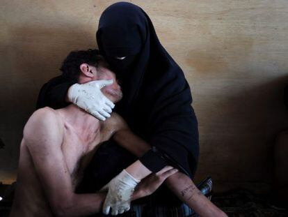 The photograph of a wounded man being held by a family member in Sana, Yemen. 