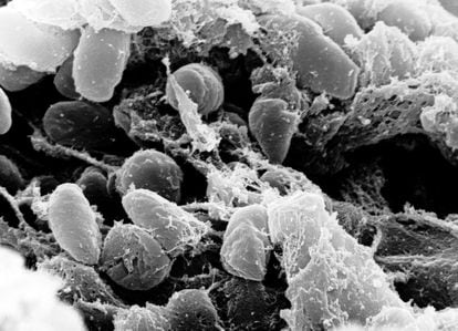 Bubonic plague case confirmed in Oregon What you need to know U.S