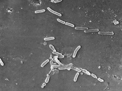 This scanning electron microscope image made available by the Centers for Disease Control and Prevention shows rod-shaped Pseudomonas aeruginosa bacteria.