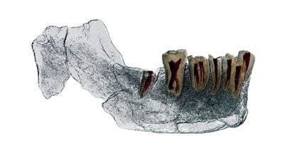 An x-ray image of the jaw of the Nesher Ramla ‘Homo.’